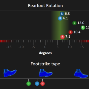 מעבדה להתאמת נעליים